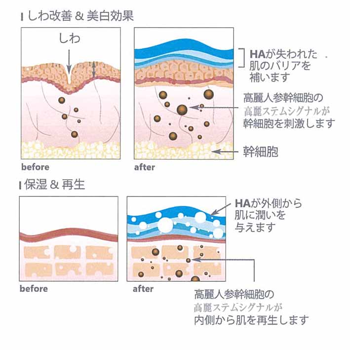 高麗人参幹細胞の美容液をたっぷり導入 新メニュー シンシアガーデンクリニック新着情報