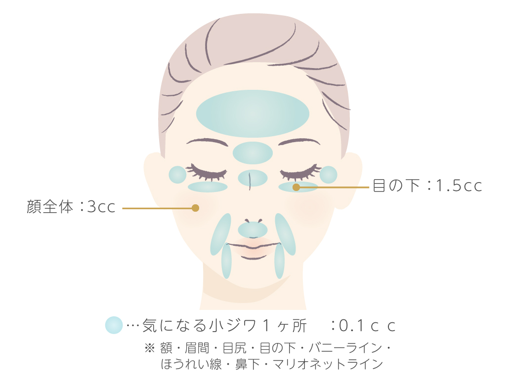 注入部位と目安量