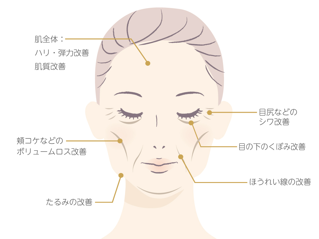 真皮線維芽細胞療法の効果