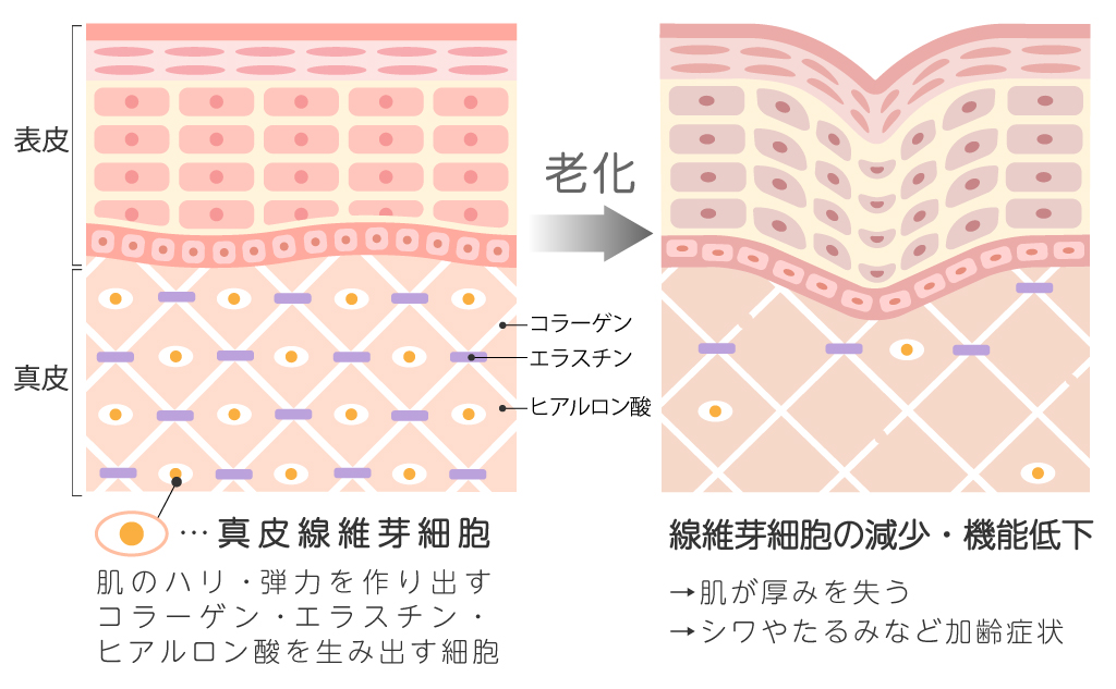 老化による真皮線維芽細胞の減少