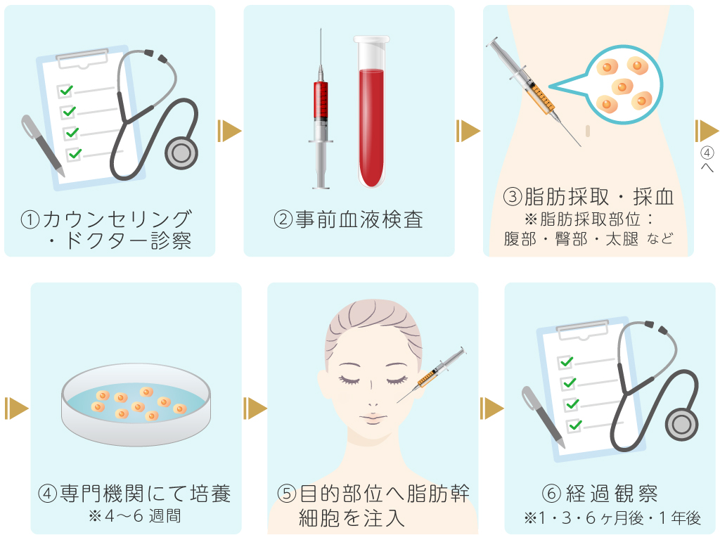 自己脂肪幹細胞治療の流れ