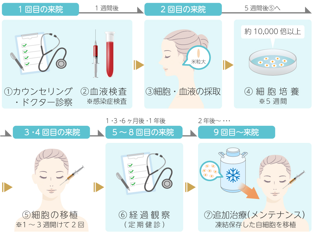 真皮線維芽細胞療法の施術の流れ